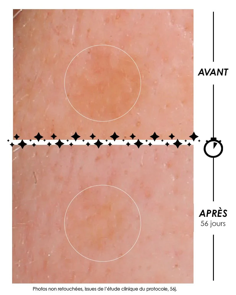 Éclair de Lune La Foudroyante - Crème lactée anti-taches - Image 3