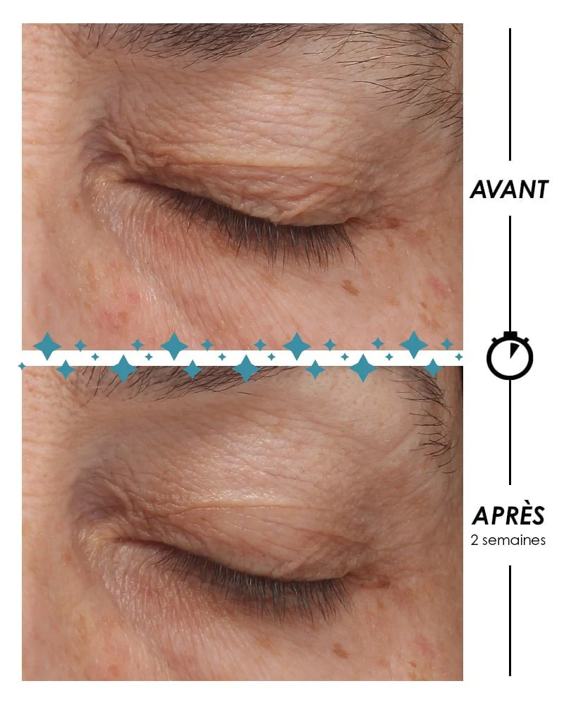 [ ÉTOILE POLAIRE ] Le contour des yeux - Image 3